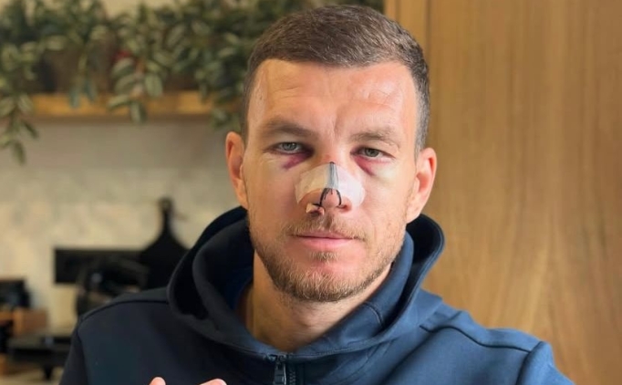 edin dzekodan sakatlik paylasimi hhqnqAIk